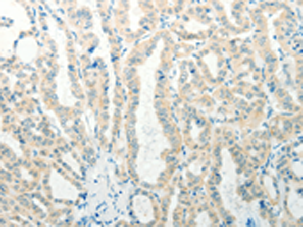 Rabbit Polyclonal Antibody to RAB25