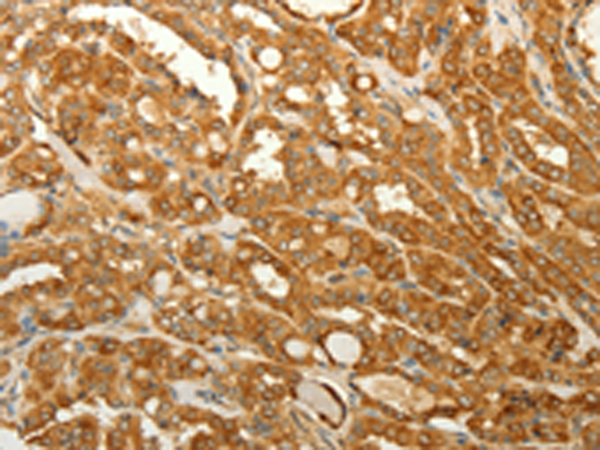 Rabbit Polyclonal Antibody to RAB35
