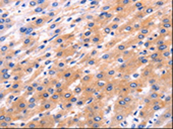 Rabbit Polyclonal Antibody to RAB39A