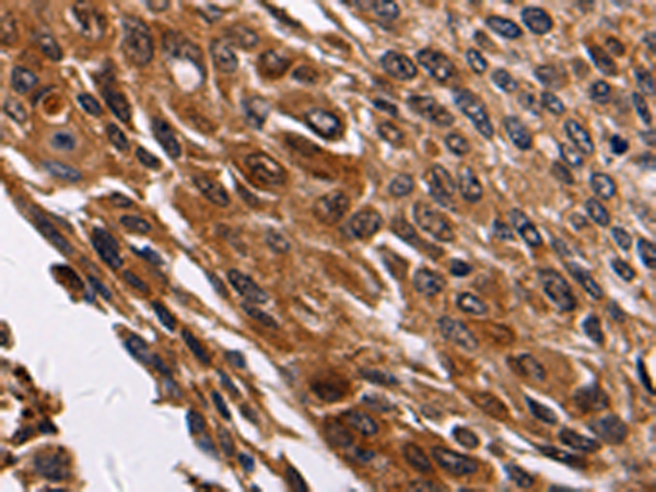Rabbit Polyclonal Antibody to RAB41