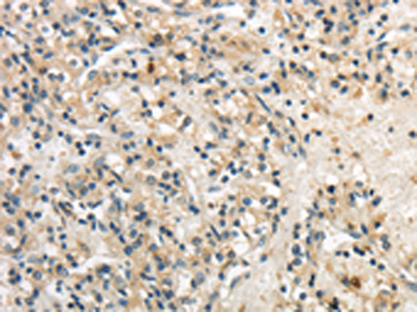 Rabbit Polyclonal Antibody to GPT