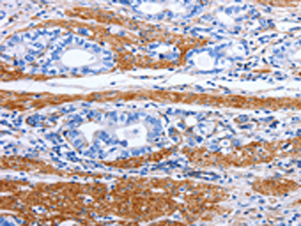 Rabbit Polyclonal Antibody to PRKAB1