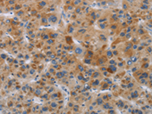 Rabbit Polyclonal Antibody to IAPP
