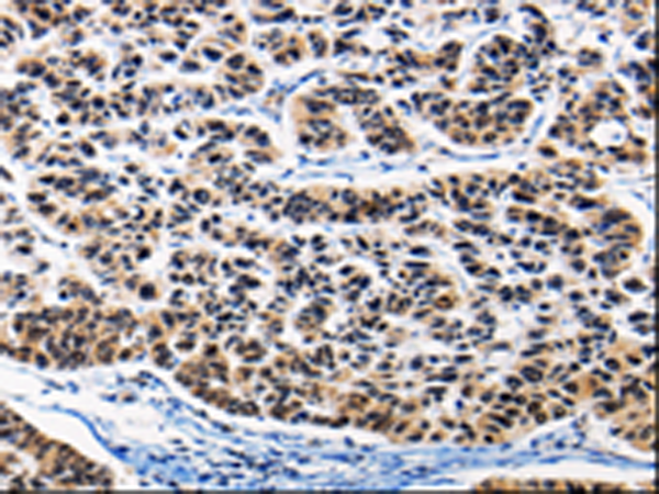 Rabbit Polyclonal Antibody to AP1B1