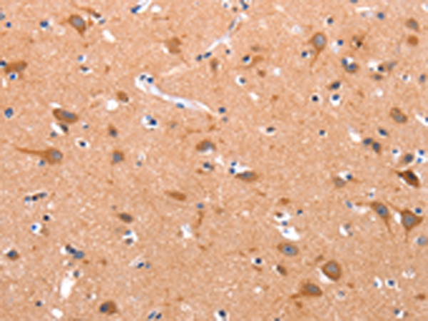 Rabbit Polyclonal Antibody to APAF1