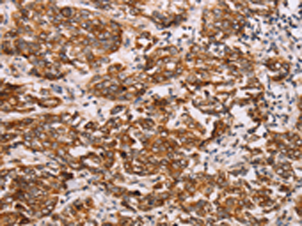 Rabbit Polyclonal Antibody to RAB3D