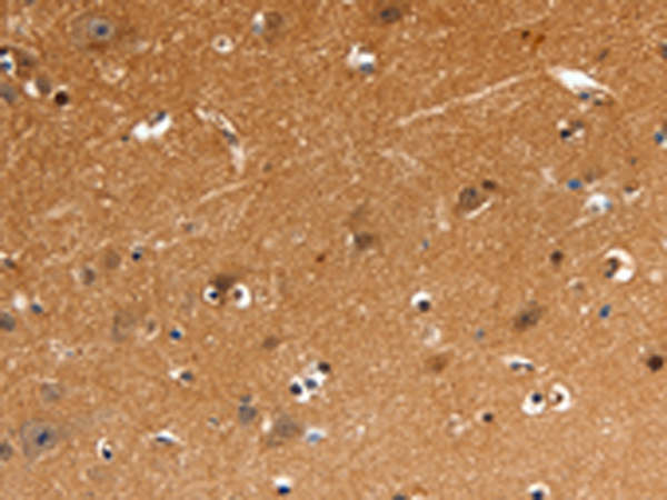 Rabbit Polyclonal Antibody to GNAZ