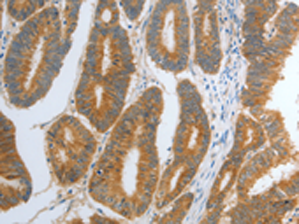 Rabbit Polyclonal Antibody to RHEB