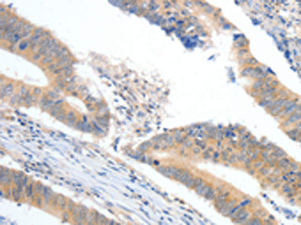 Rabbit Polyclonal Antibody to APOB