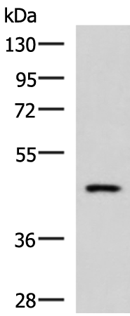 Rabbit Polyclonal Antibody to HAVCR1