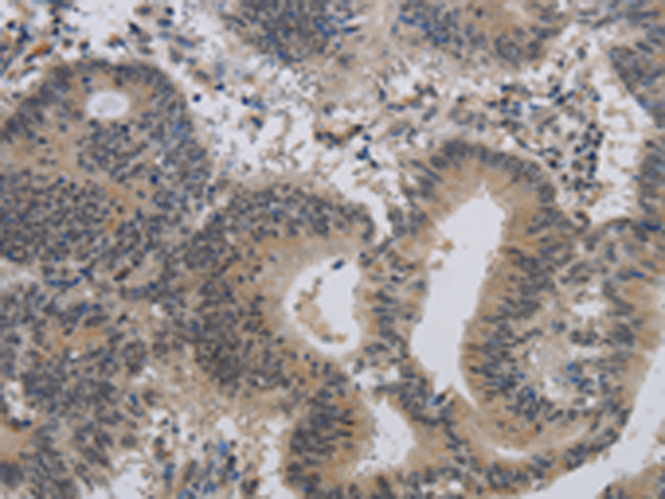 Rabbit Polyclonal Antibody to ALX4