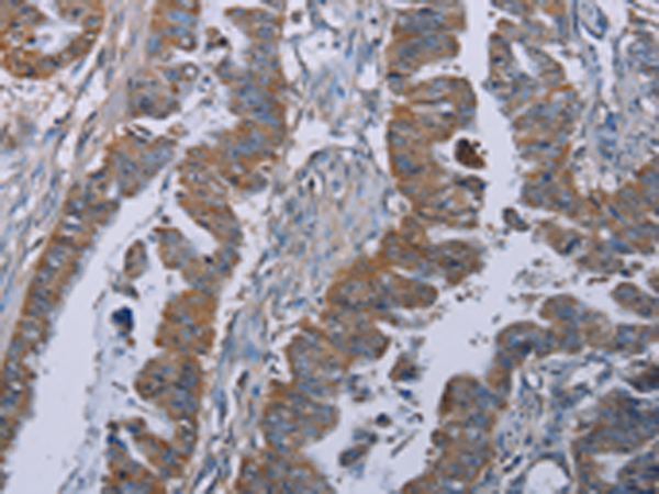 Rabbit Polyclonal Antibody to BMP3