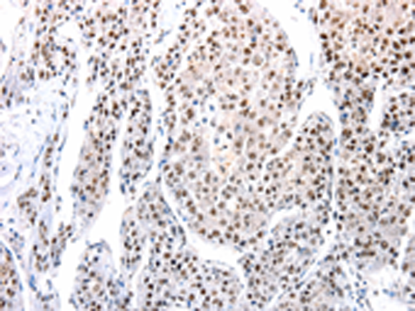 Rabbit Polyclonal Antibody to AQP2