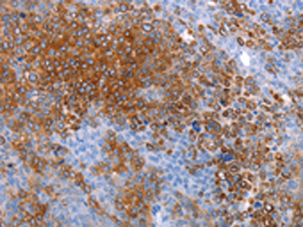 Rabbit Polyclonal Antibody to AQP5