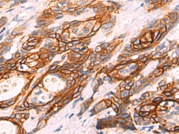 Rabbit Polyclonal Antibody to AQP3