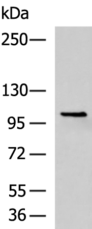 Rabbit Polyclonal Antibody to AR