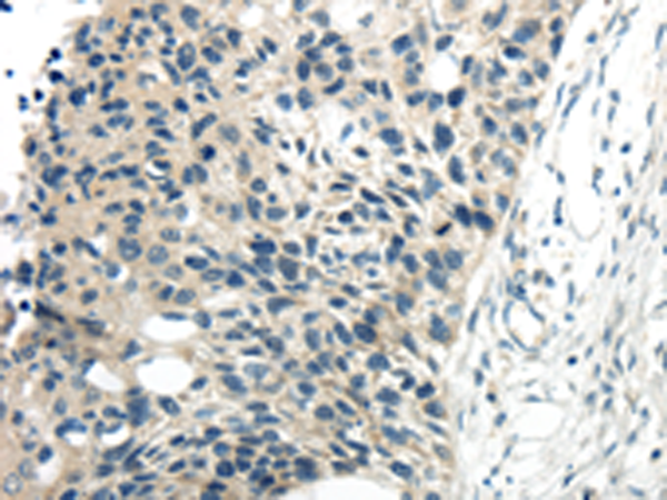 Rabbit Polyclonal Antibody to CYP19A1