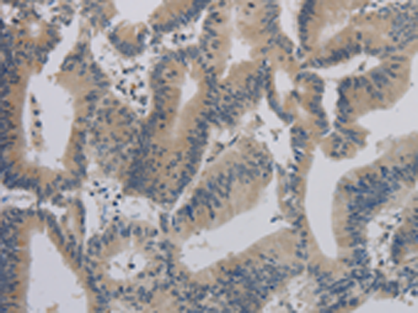 Rabbit Polyclonal Antibody to ACVR1B