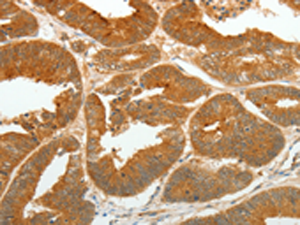 Rabbit Polyclonal Antibody to ASCL1