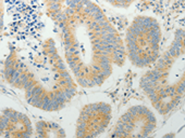 Rabbit Polyclonal Antibody to TP53BP2