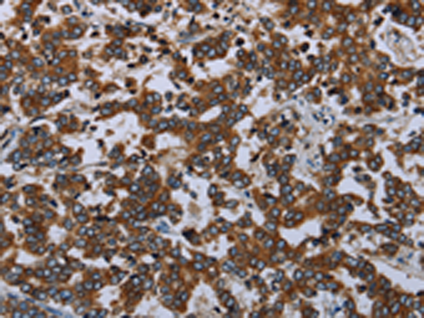 Rabbit Polyclonal Antibody to AVEN