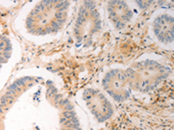 Rabbit Polyclonal Antibody to AVPR2