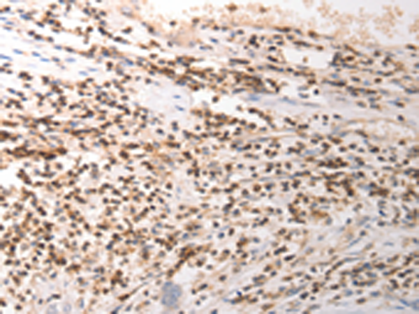 Rabbit Polyclonal Antibody to VTCN1
