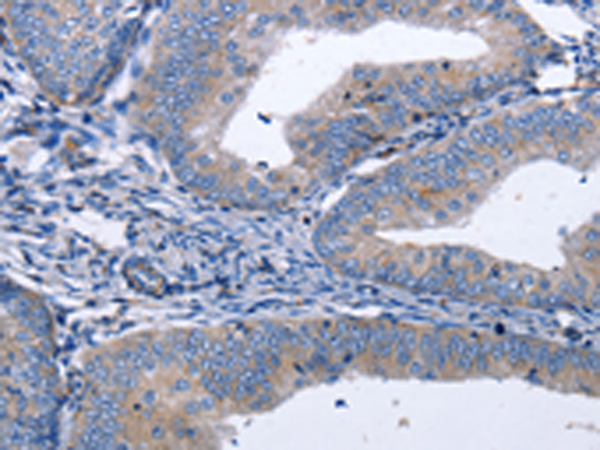 Rabbit Polyclonal Antibody to BDNF