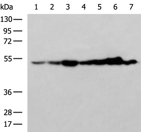 Rabbit Polyclonal Antibody to BECN1