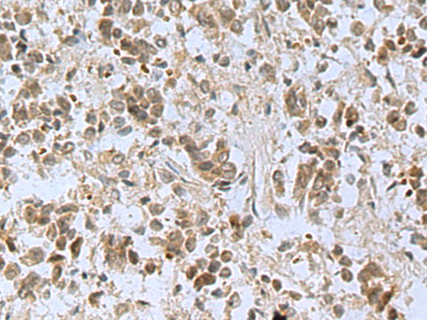 Rabbit Polyclonal Antibody to FGF2