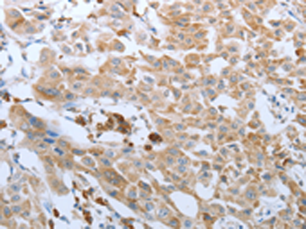 Rabbit Polyclonal Antibody to FGF1