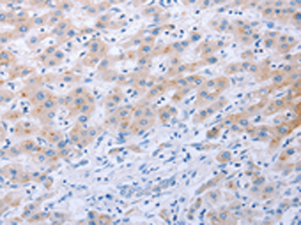 Rabbit Polyclonal Antibody to FGF4