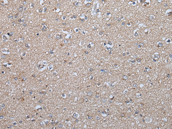 Rabbit Polyclonal Antibody to FGF5