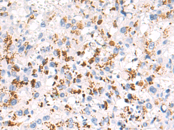 Rabbit Polyclonal Antibody to FGF7