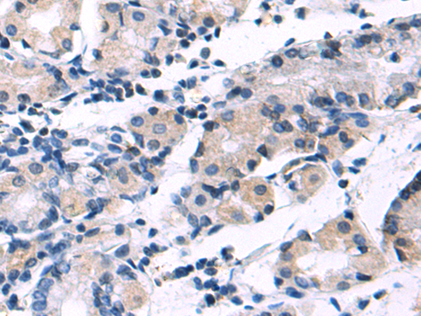 Rabbit Polyclonal Antibody to BGLAP