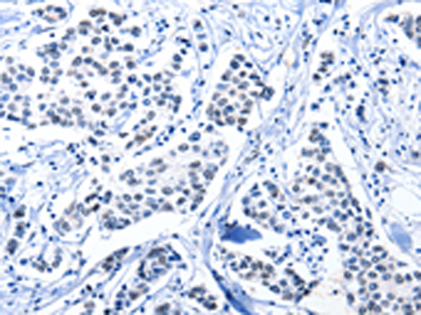 Rabbit Polyclonal Antibody to POU2AF1
