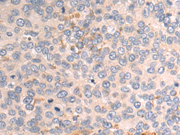 Rabbit Polyclonal Antibody to NPPB