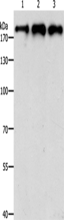 Rabbit Polyclonal Antibody to SMARCA4