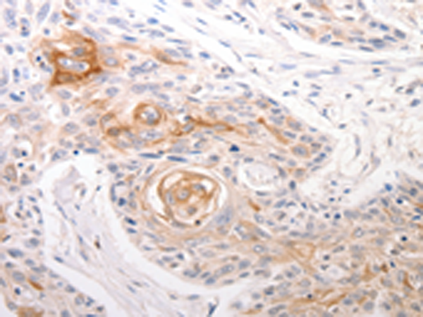 Rabbit Polyclonal Antibody to DFFB