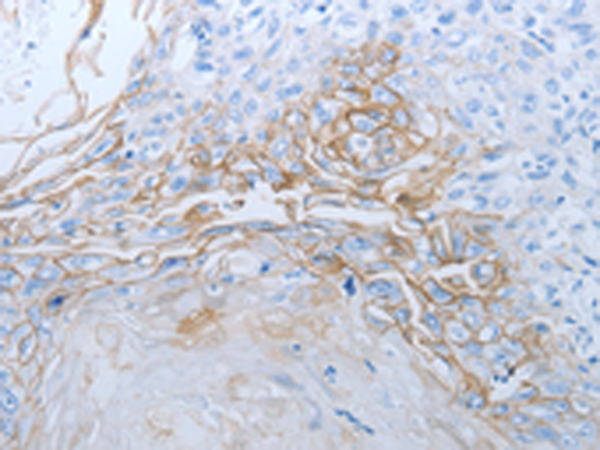 Rabbit Polyclonal Antibody to JUP