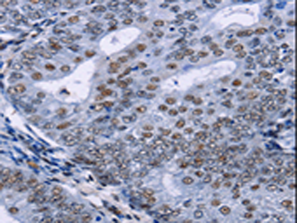 Rabbit Polyclonal Antibody to CREBBP