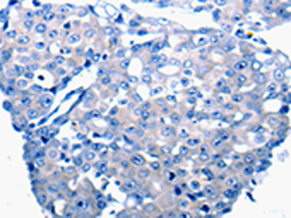 Rabbit Polyclonal Antibody to CCL2