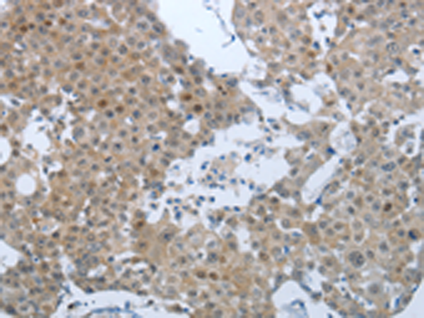 Rabbit Polyclonal Antibody to CCL15