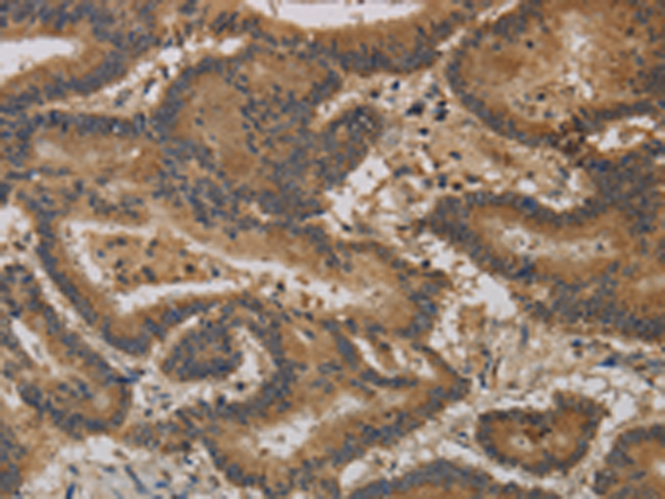 Rabbit Polyclonal Antibody to CCL26