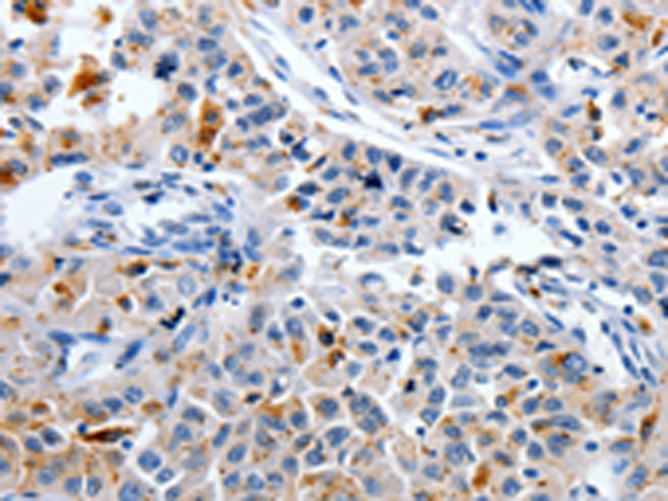 Rabbit Polyclonal Antibody to CDK3