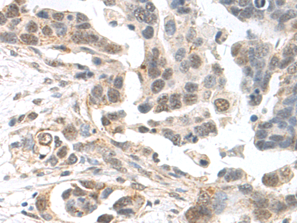 Rabbit Polyclonal Antibody to CDKN1C