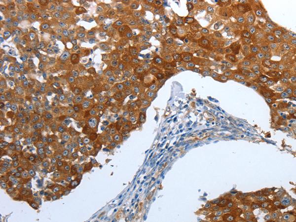 Rabbit Polyclonal Antibody to CEACAM5