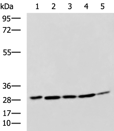 Rabbit Polyclonal Antibody to CEBPD