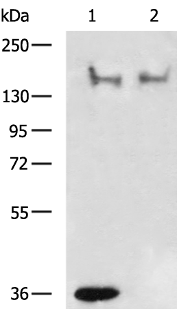 Rabbit Polyclonal Antibody to ERBB2