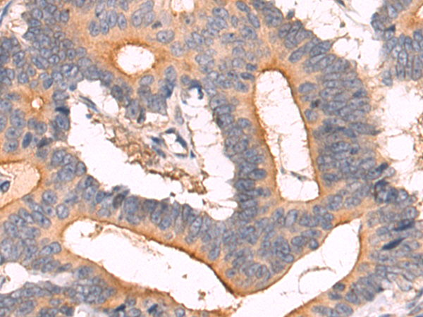 Rabbit Polyclonal Antibody to CFTR